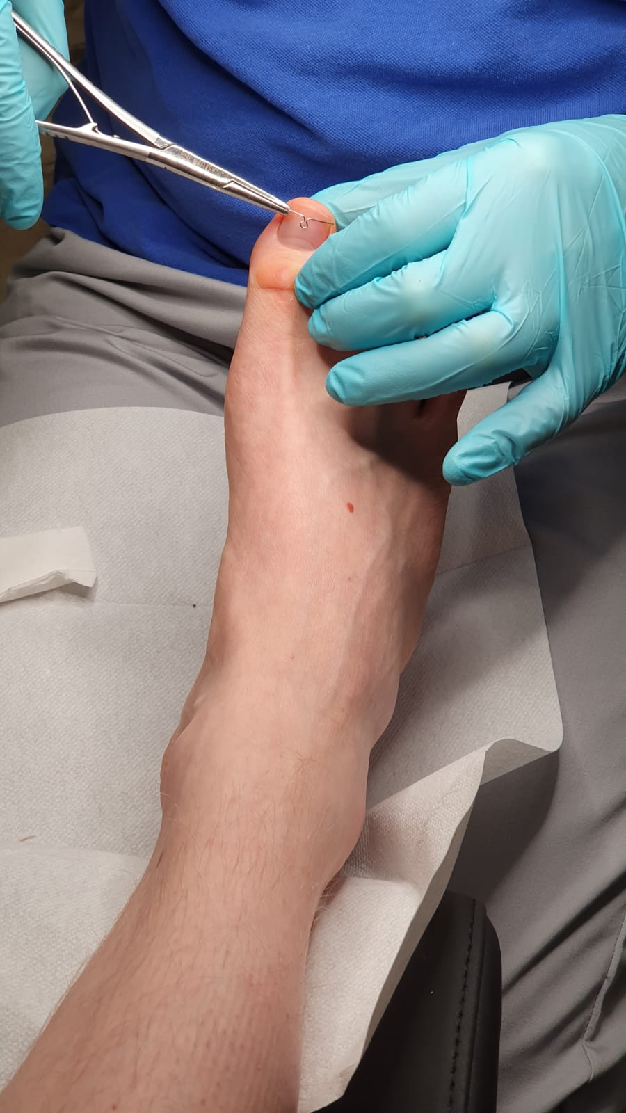 Professionelle podologische Behandlung und Leistungen